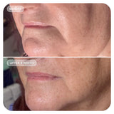 Vol.U.Lift - Image Skincare