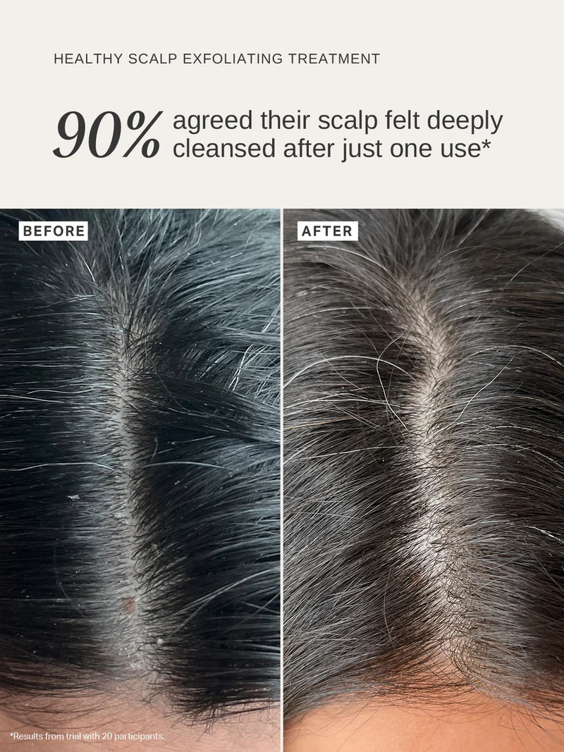 healthy scalp exfoliating threatment- brainsforbeauty- alpha h